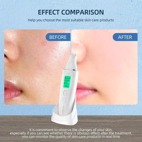 Medidor Tester Humedad Aceite Elasticidad Piel Lcd Digital